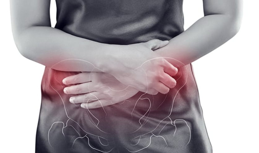 Chronic Pelvic Pain in Women - Center for Vascular Medicine