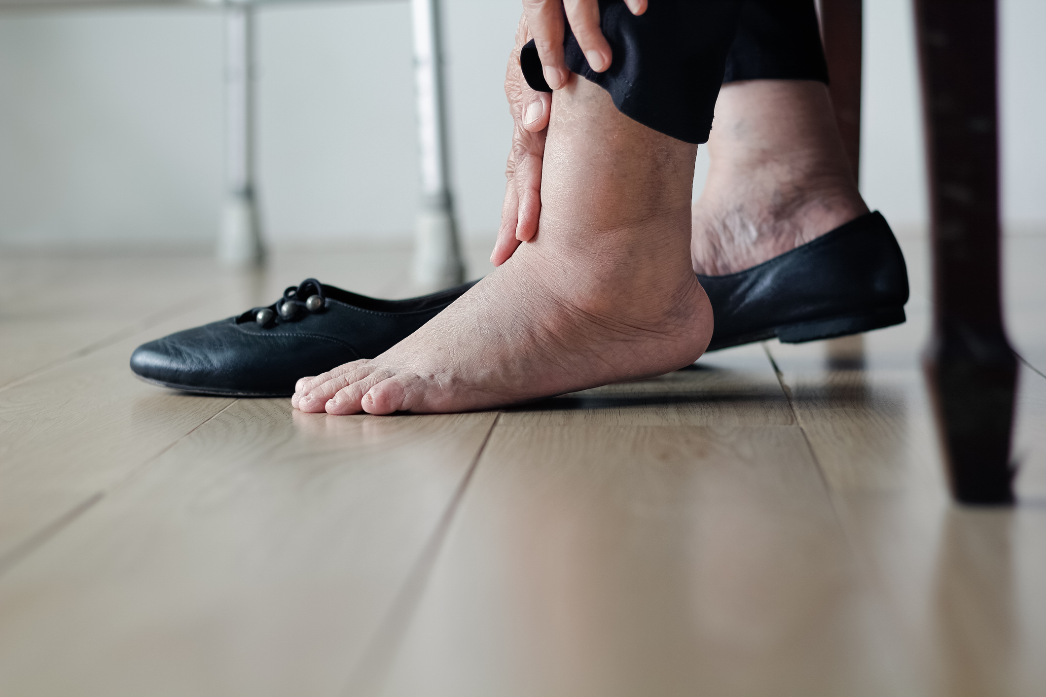 What Can Cause One Swollen Ankle Without Pain?