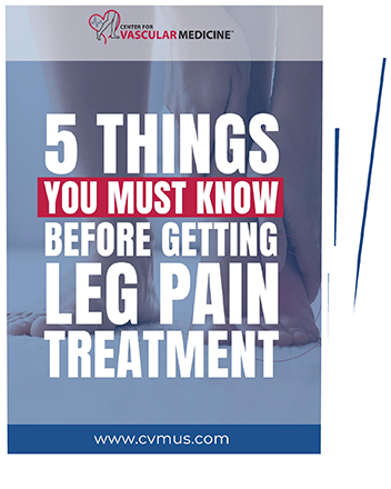 5 things you must know before getting leg pain treatment.