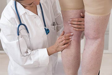 A vascular medicine specialist inspects a patient's leg