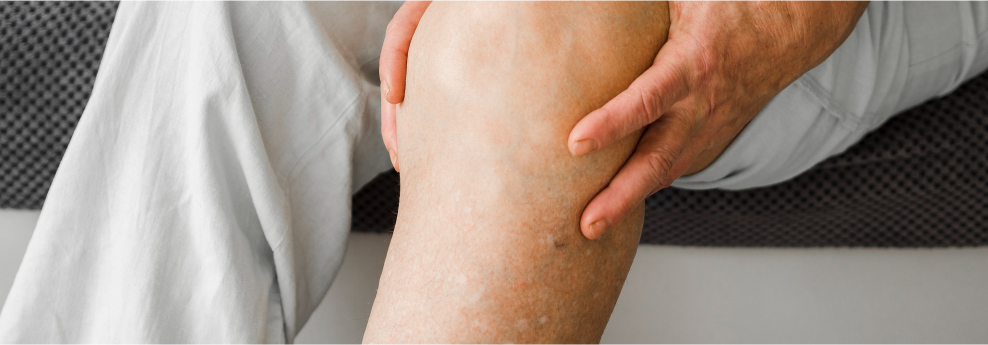 Common Causes of Leg Ulcers