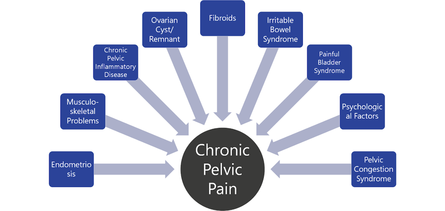 Pelvic Congestion Syndrome