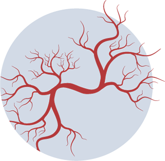 CVM's vascular doctors are well versed in treating conditions affecting veins
